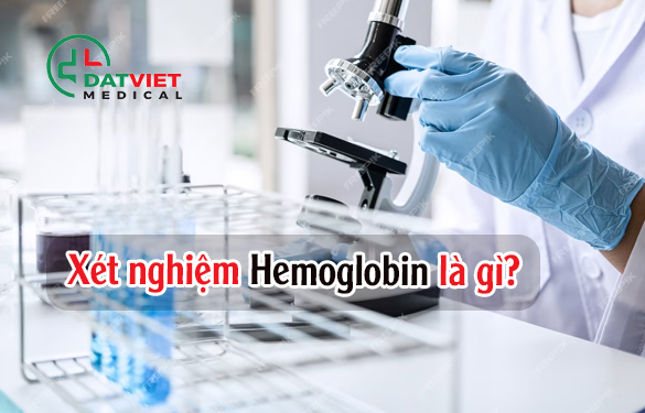 xét nghiệm hemoglobin là gì