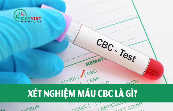 xét nghiệm máu cbc là gì?