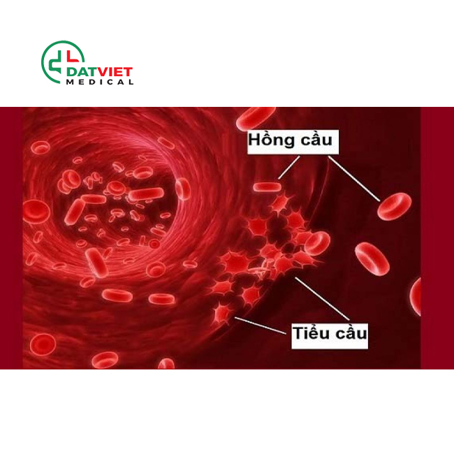 ý nghĩa của xét nghiệm máu cbc