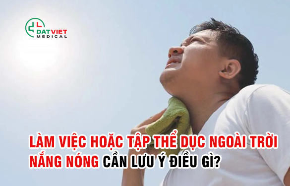 những lưu ý khi làm việc dưới trời nóng