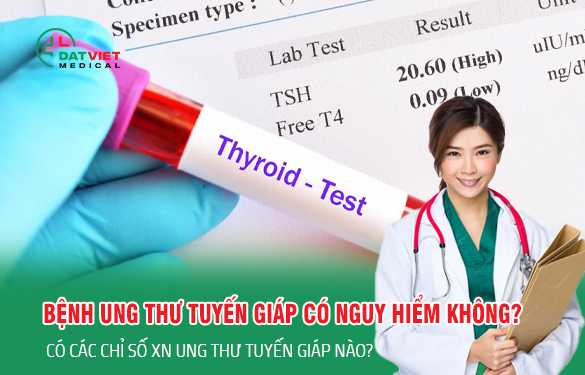 chỉ số bệnh ung thư tuyến giáp