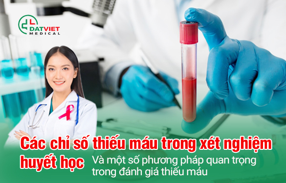 những chỉ số thiếu máu trong huyết học