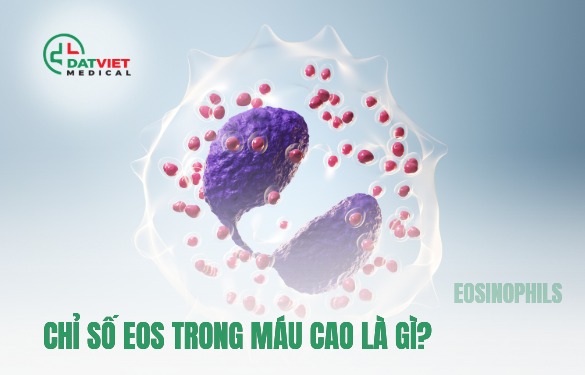 chỉ số eos trong máu cao là gì?