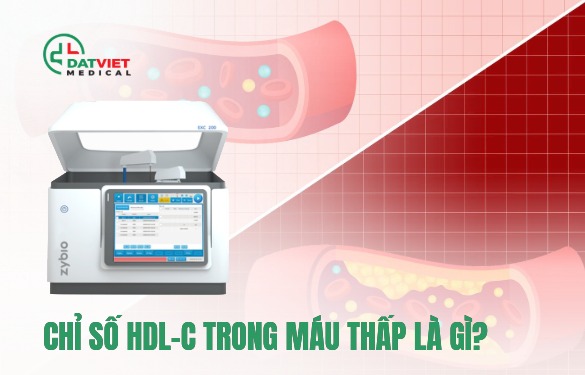 chỉ số hdl c trong máu thấp có  ý nghĩa gì