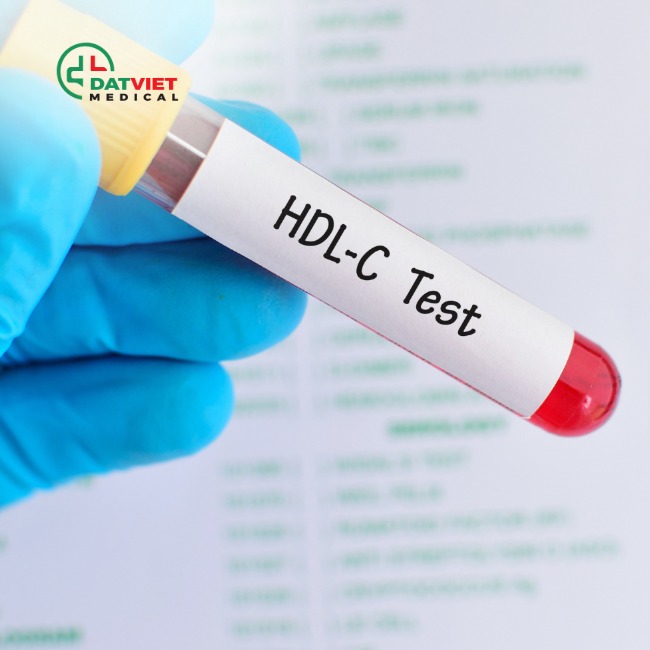 tìm hiểu chỉ số hdl c trong máu thấp có  ý nghĩa gì