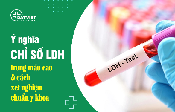 Bật mí ý nghĩa về chỉ số xét nghiệm LDH