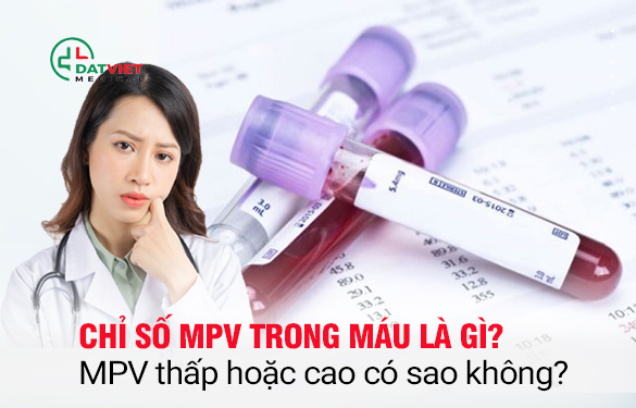 Chỉ số MPV trong máu mang ý nghĩa gì?