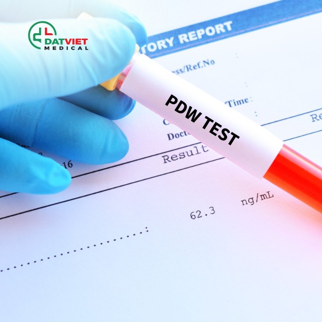 tìm hiểu ý nghĩa của chỉ số pdw trong máu