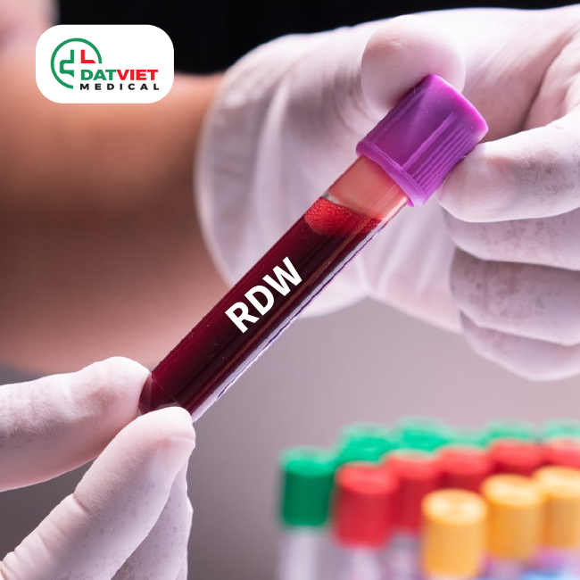 tìm hiểu ý nghĩa của chỉ số rdw