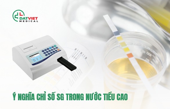 chỉ số sg trong nước tiểu cao có sao không