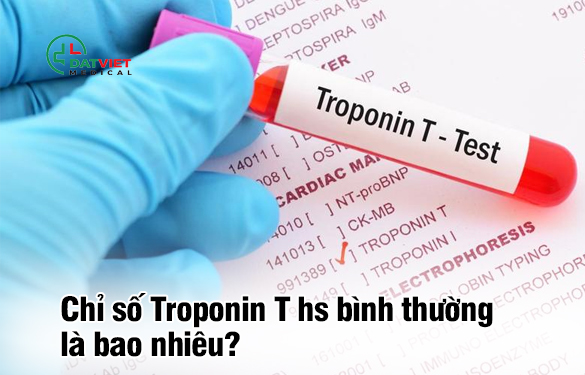 Chỉ số Troponin T hs bình thường