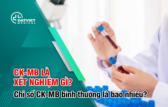 chỉ số ck mb bao nhiêu là tốt