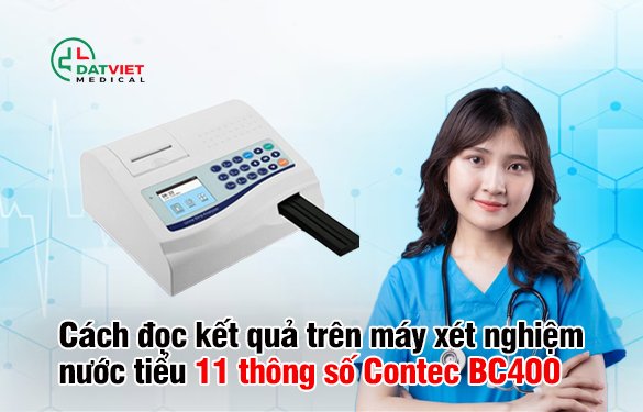 cách đọc kết quả máy xét nghiệm nước tiểu