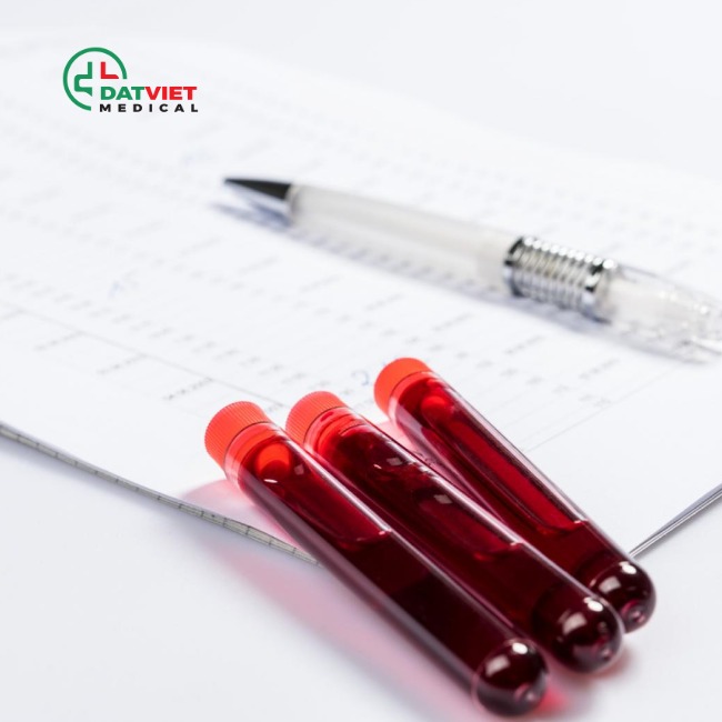 mua máy xét nghiệm miễn dịch exi 1820