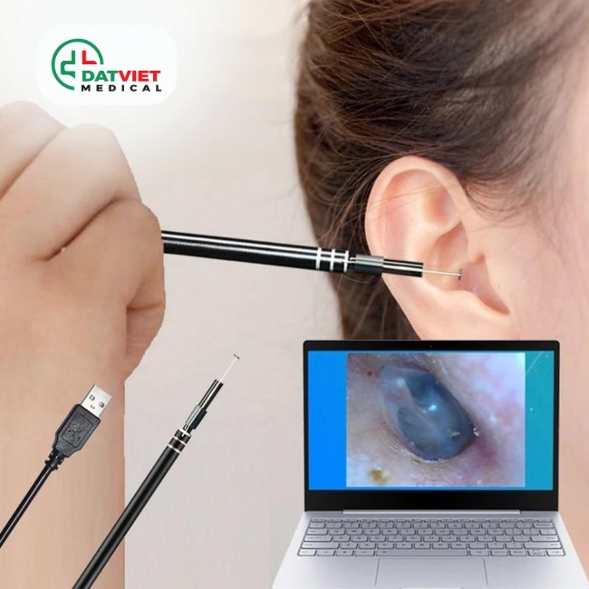 máy nội soi tai mũi họng mini nào tốt