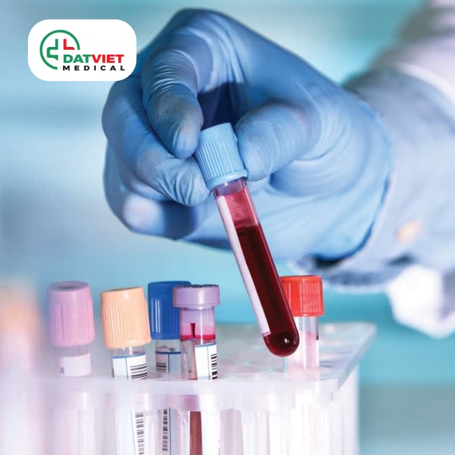 máy xét nghiệm huyết học cobas c311
