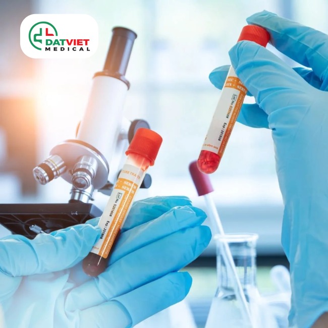 máy xét nghiệm điện giải ims 972