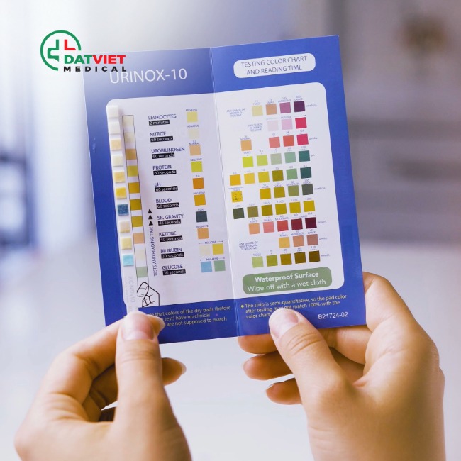 máy xét nghiệm nước tiểu 13 thông số nào tốt