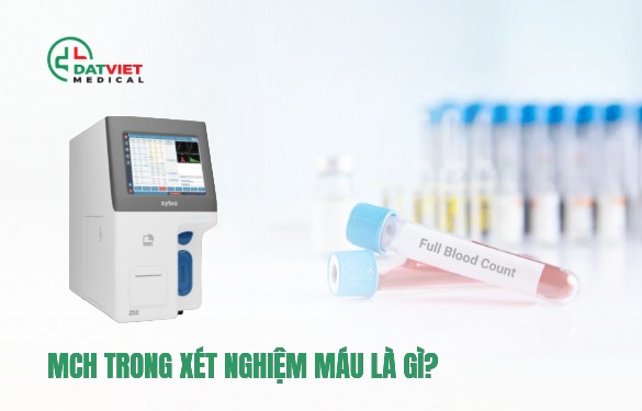 chỉ số mch trong xét nghiệm máu là gì