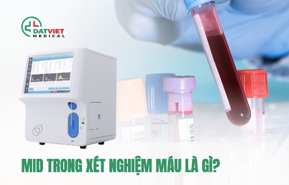tìm hiểu mid trong xét nghiệm máu