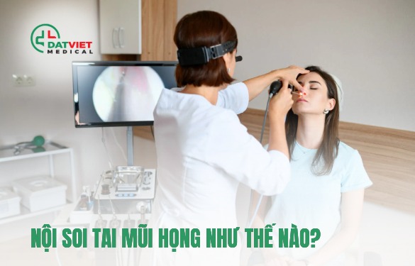 nội soi tai mũi họng