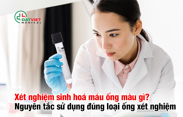 Xét nghiệm sinh hóa máu ống màu gì?