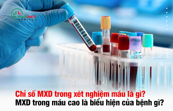 mxd trong xét nghiệm máu là gì? Hiểu rõ ý nghĩa và tầm quan trọng