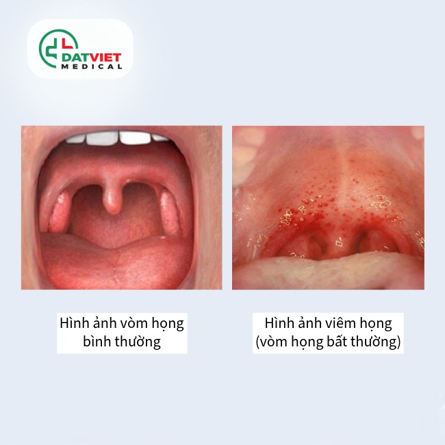 tìm hiểu về nội soi tai mũi họng