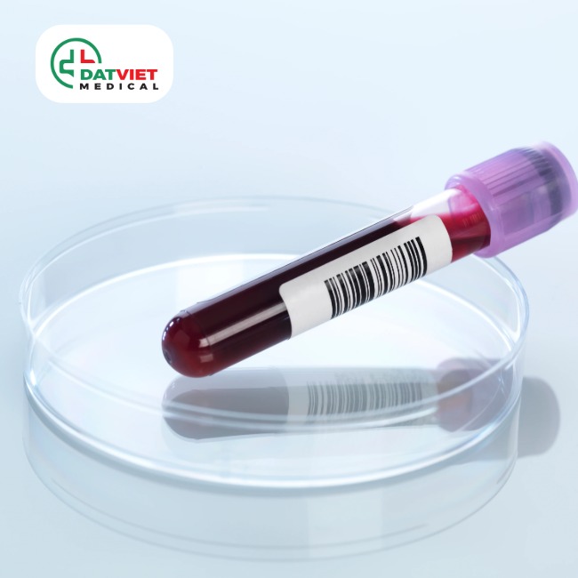 vai trò của xét nghiệm chỉ số mid trong máu