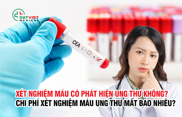 xét nghiệm máu phát hiện bệnh gì