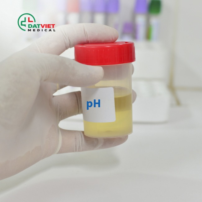 xét nghiệm nước tiểu 24 giờ làm gì