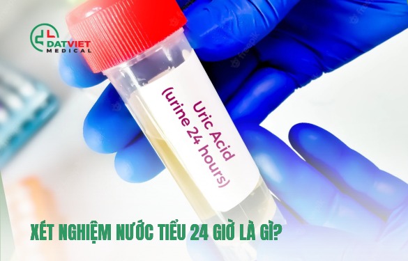 xét nghiệm nước tiểu 24 giờ