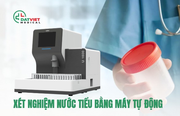 máy xét nghiệm nước tiểu nào tốt