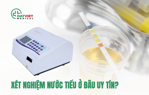 xét nghiệm nước tiểu ở đâu tốt