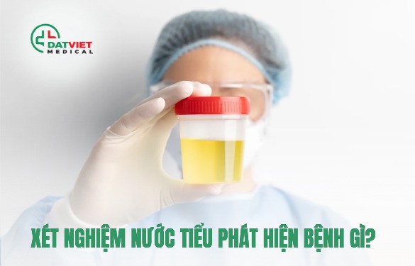 xét nghiệm nước tiểu phát hiện bệnh gì