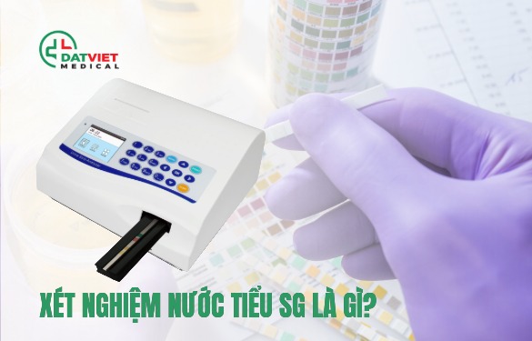 xét nghiệm nước tiểu sg làm gì