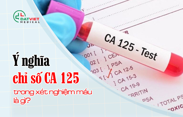 tìm hiểu ý nghĩa chỉ số ca 125